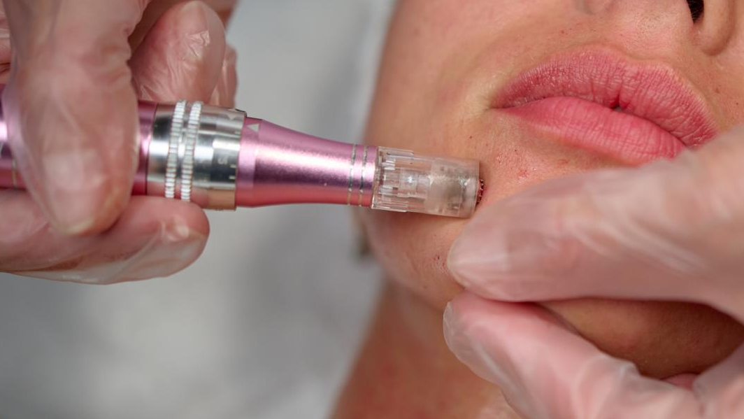Facial Deposit