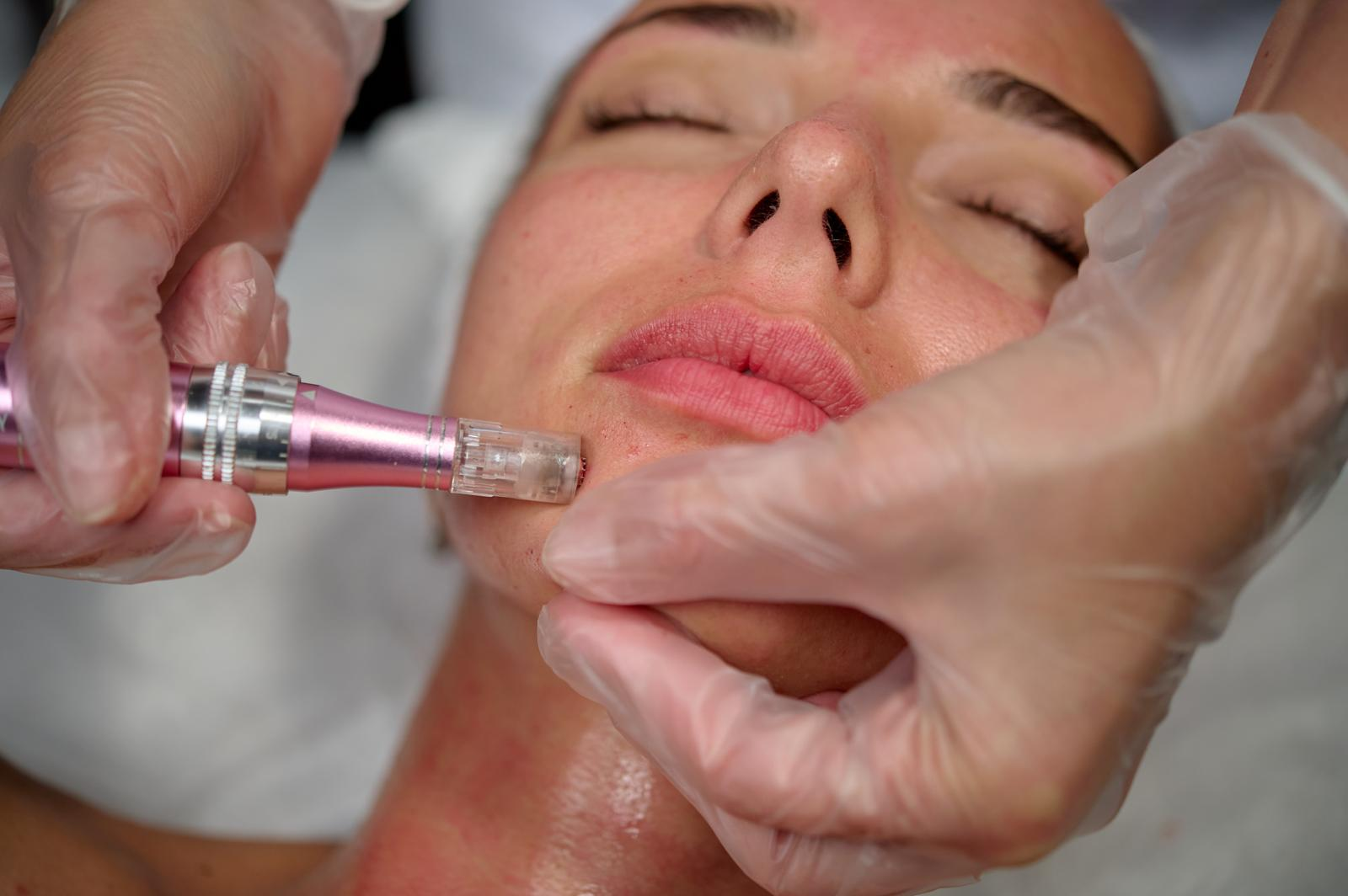 Facials